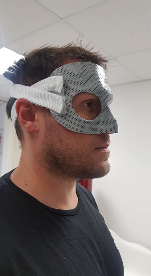 Masque de protection sur mesure suite à une fracture du nez